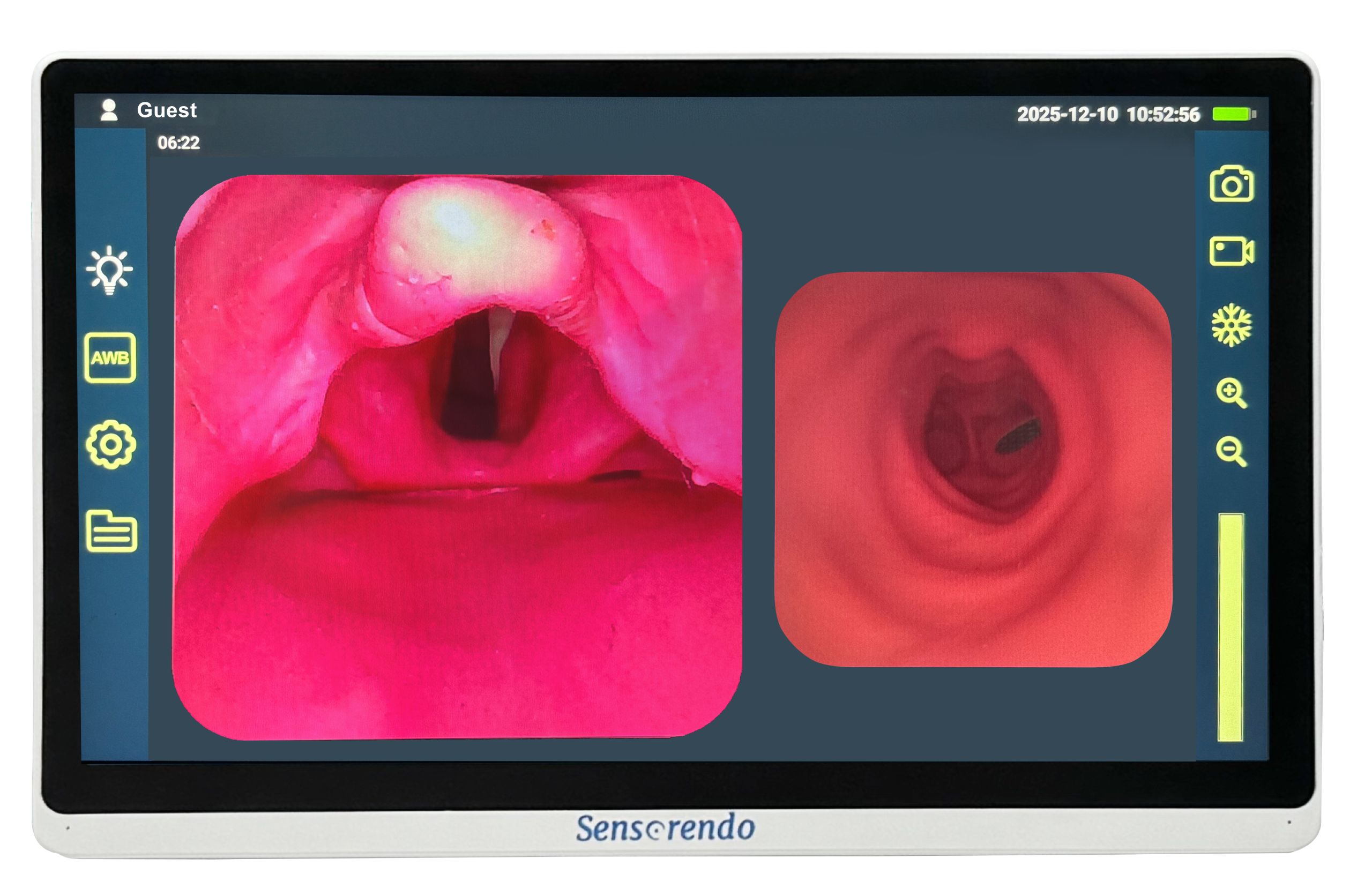 15 inch touchscreen